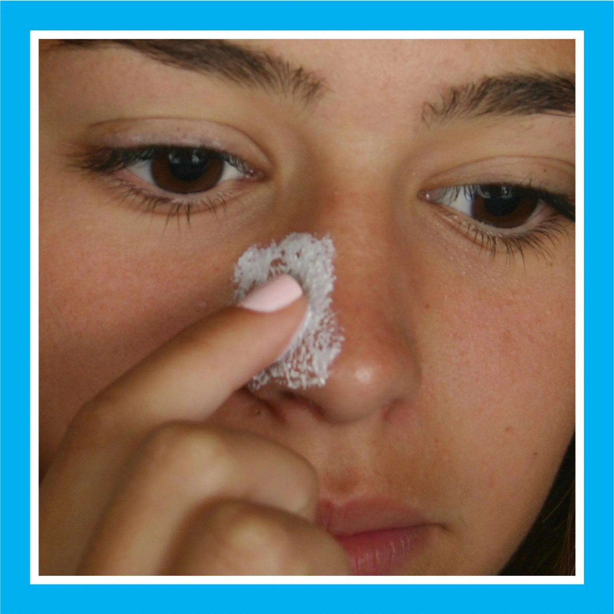 Blackhead Eliminator Kit